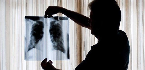 midia indoor wap pulmao amianto cancer doencas respiratorias problemas saude raio x exame radiografi